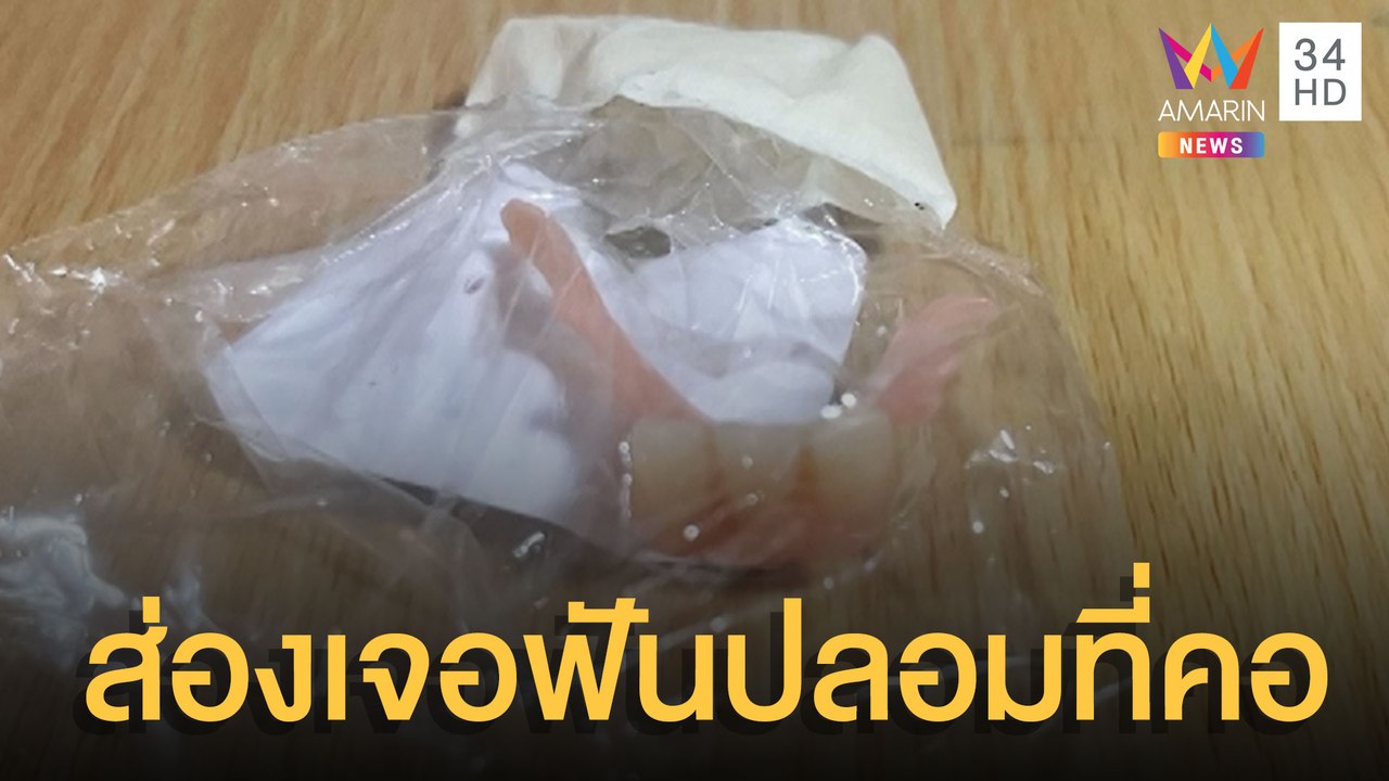 อุทาหรณ์ บ้านไหนมีคนชรา ระวังฟันปลอมติดคอ | ข่า...