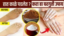 हातांचं tanning घालवण्यासाठी घरगुती उपाय | How To Remove Tan From Hands | Tan Removal Home Remedies
