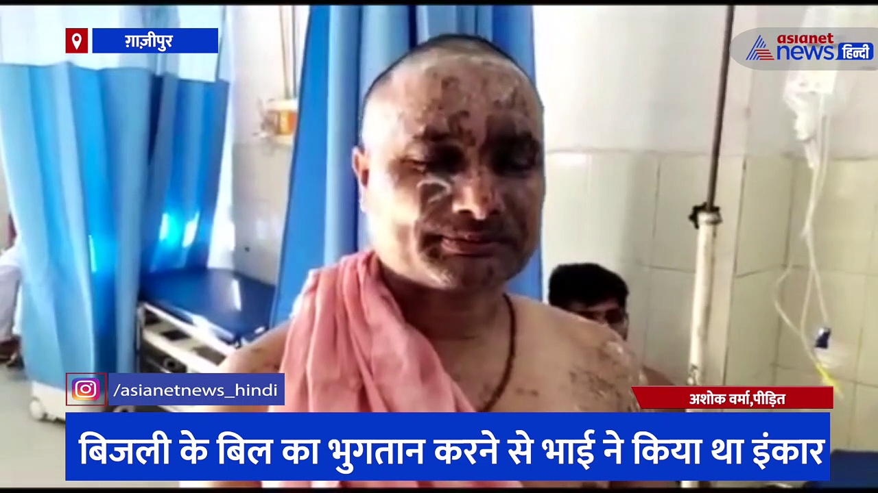 मामूली कहासुनी के बीच युवक ने दिखाई हैवानियत, अपने भाई समेत परिवार के 5 लोगों पर फेंक दिया एसिड