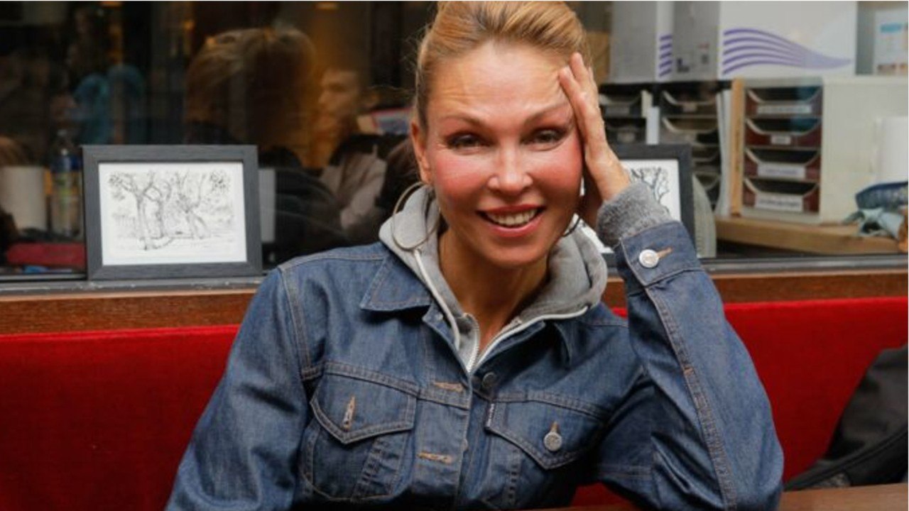 GALA VIDEO - “Je sentais le visage se vider” : la chanteuse Indra “en souffrance” après une injection de Botox®