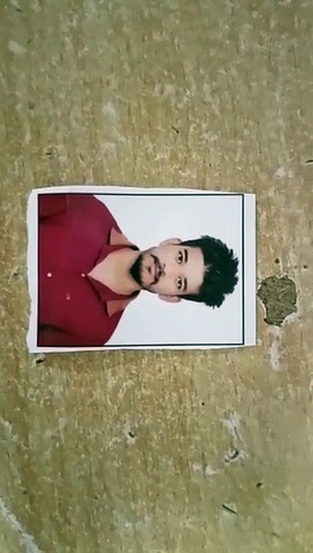 शबाश कोटा मेडिकल टीम... दूसरा किडनी ट्रांसप्लांट भी हुआ सफल