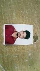 शबाश कोटा मेडिकल टीम... दूसरा किडनी ट्रांसप्लांट भी हुआ सफल