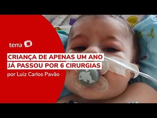 Caso raro: conheça o bebê que nasceu com três braços e metade do coração