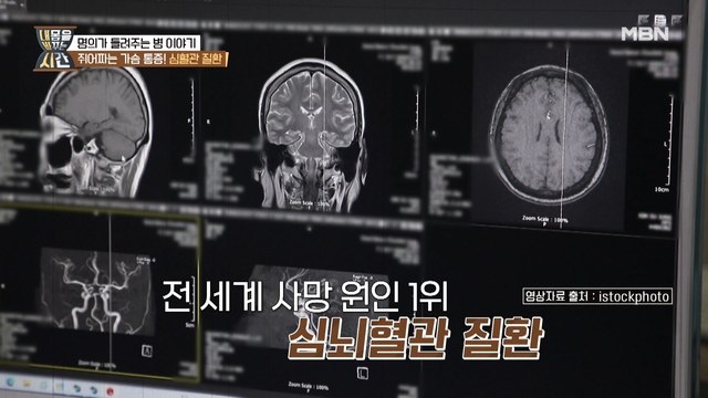 혈관 70%가 막혀야 나타나는 증상? 몸속 시한폭탄 심뇌혈관 질환