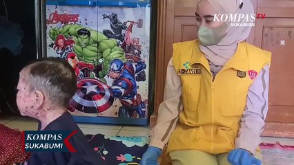 Perjuangan Seorang Anak Alami Vesikobulosa Selama 5 Tahun