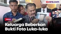 Laporan Dugaan Pembunuhan Berencana Brigadir J Diterima Bareskrim Polri, Keluarga Beberkan Bukti