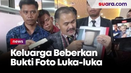 Laporan Dugaan Pembunuhan Berencana Brigadir J Diterima Bareskrim Polri, Keluarga Beberkan Bukti