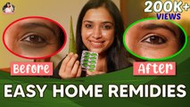 Easy Homecare Remedies For Skin Lightening _ Dark Circles _ Swetha Changappa