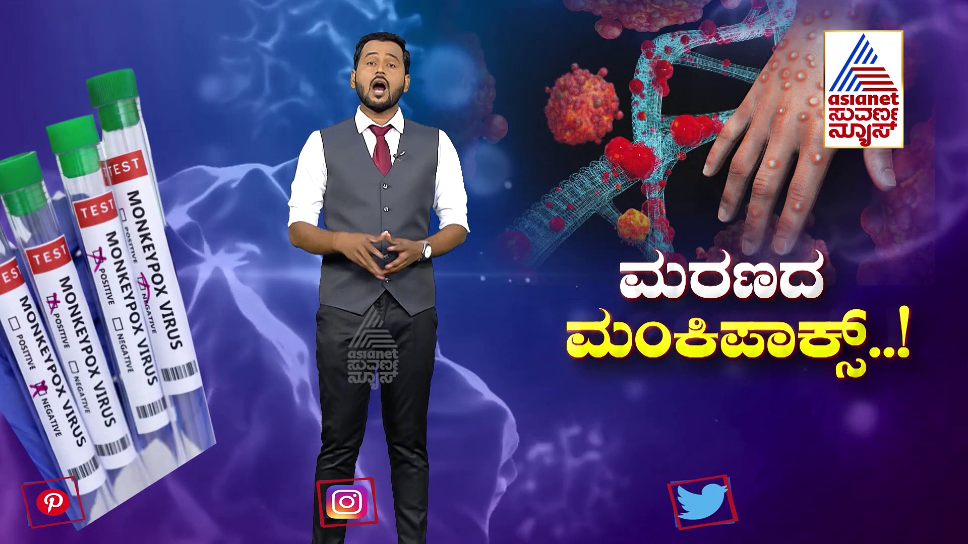 ಭಾರತಕ್ಕೆ ಮಂಕಿಪಾಕ್ಸ್​ ಎಂಟ್ರಿ, ಕೇರಳದಲ್ಲಿ ಹೈ ಅಲರ್ಟ್: ಈ ವೈರಾಣು​​ ಜನ್ಮರಹಸ್ಯವೇನು ಗೊತ್ತಾ?