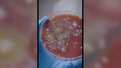 El kurutma makinelerindeki uçan bakteriler dehşet saçıyor