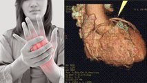 Left Hand Pain Kyun Hota hai | बाएं हाथ में दर्द होता है जानलेवा | Boldsky *Health