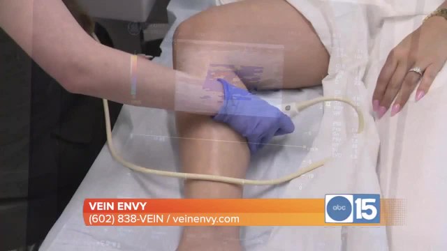 Vein Envy: Advanced, minimally invasive techniques to treat vein disease