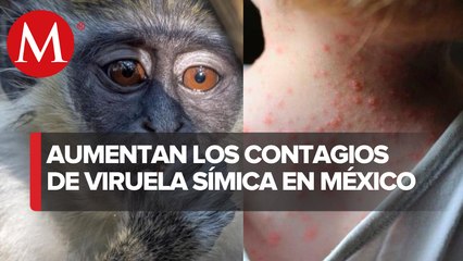 Aumenta a 48 el número de casos de viruela del mono en México: OPS