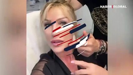 Seda Sayan yine estetik yaptırdı: Tüm işlemlerini anlattı, say say bitmedi...