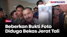 Beberkan Foto Diduga Bekas Tali di Leher, Keluarga Yakin Brigadir J Dibunuh Secara Terencana