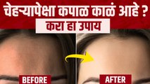 कपाळावरचा काळपटपणा कसा घालवायचा | How to Get Rid of Forehead Tan | Black Forehead Treatment