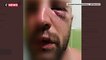 Dijon : Un policier violemment tabassé