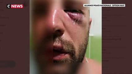 Dijon : Un policier violemment tabassé