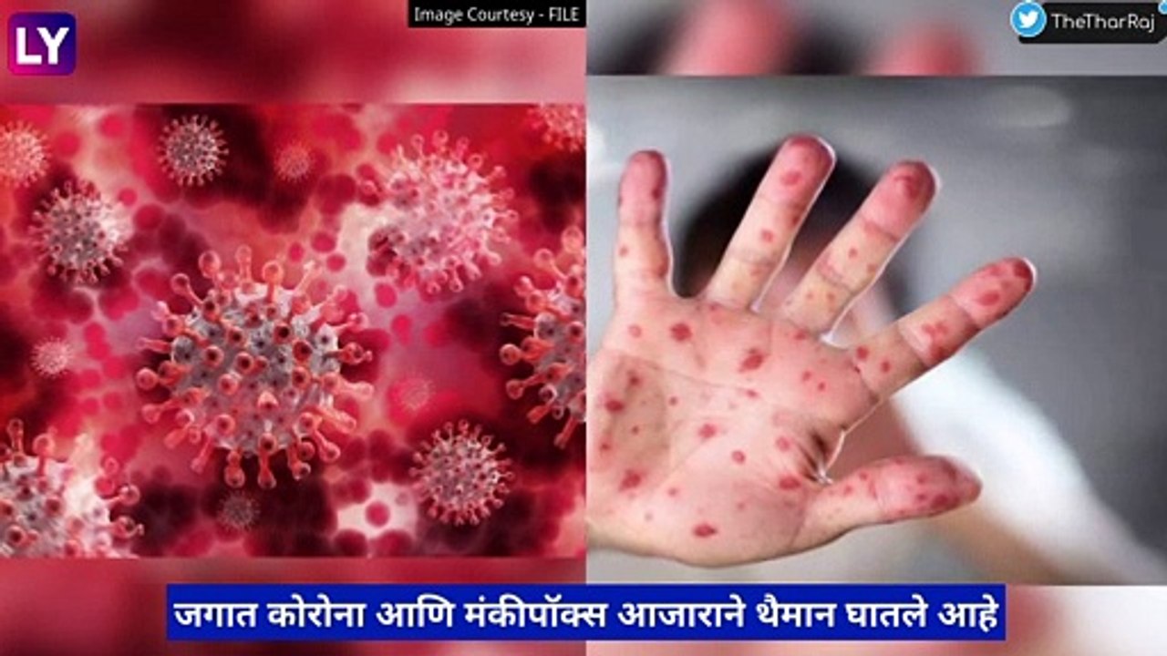 Congo Hemorrhagic Fever: काँगो फिव्हर या जीवघेण...