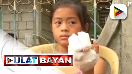 Higit 20 katao na sugatan dahil sa lindol sa Abra, nananatili sa ospital