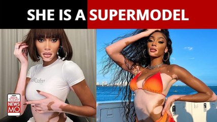 Story Of Winnie Harlow: The Supermodel with Vitiligo