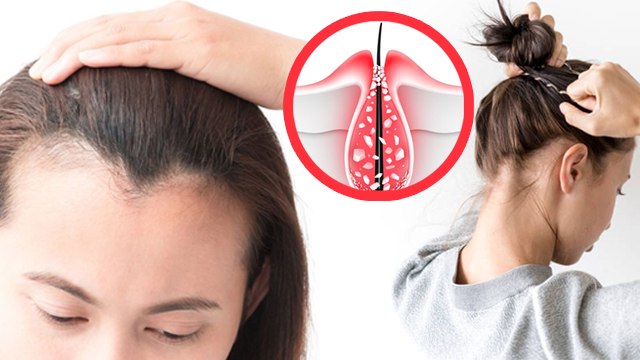 बालों का जूड़ा बनाने से क्या होता है | Balon ka Juda Banane se kya hota hai |Boldsky*Health