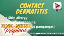 SAY NI DOK | Contact dermatitis, karaniwang nakukuha sa mga halaman at kemikal