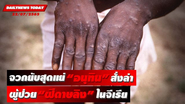 ขู่เนรเทศ! อนุทิน สั่งล่าผู้ป่วย ฝีดาษลิง ไนจีเรียจ่อใช้ก.ม.สูงสุด | DAILYNEWS TODAY 22/07/65