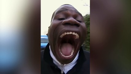 Dünyanın en geniş ağızlı insanı: Ağzı tam 16.9 CM açılıyor