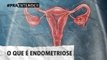 Endometriose: vídeo explica possíveis causas e tratamento da doença