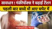 Monkeypox Virus की बड़ी आफत ! बच्चे कहां आए चपेट में ? Monkeypox In India, US | वनइंडिया हिंदी *News
