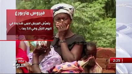 استشاري: فيروس ماربورغ يحتاج لتلامس وثيق لنقل العدوى لكن نسبة الوفاة به عالية