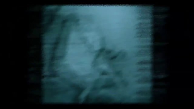 Mhp'de 10 Yöneticinin Seks Kaseti Yayınlandı - Bahçeli'yi Çıldırtacak İfşalar #sondakika