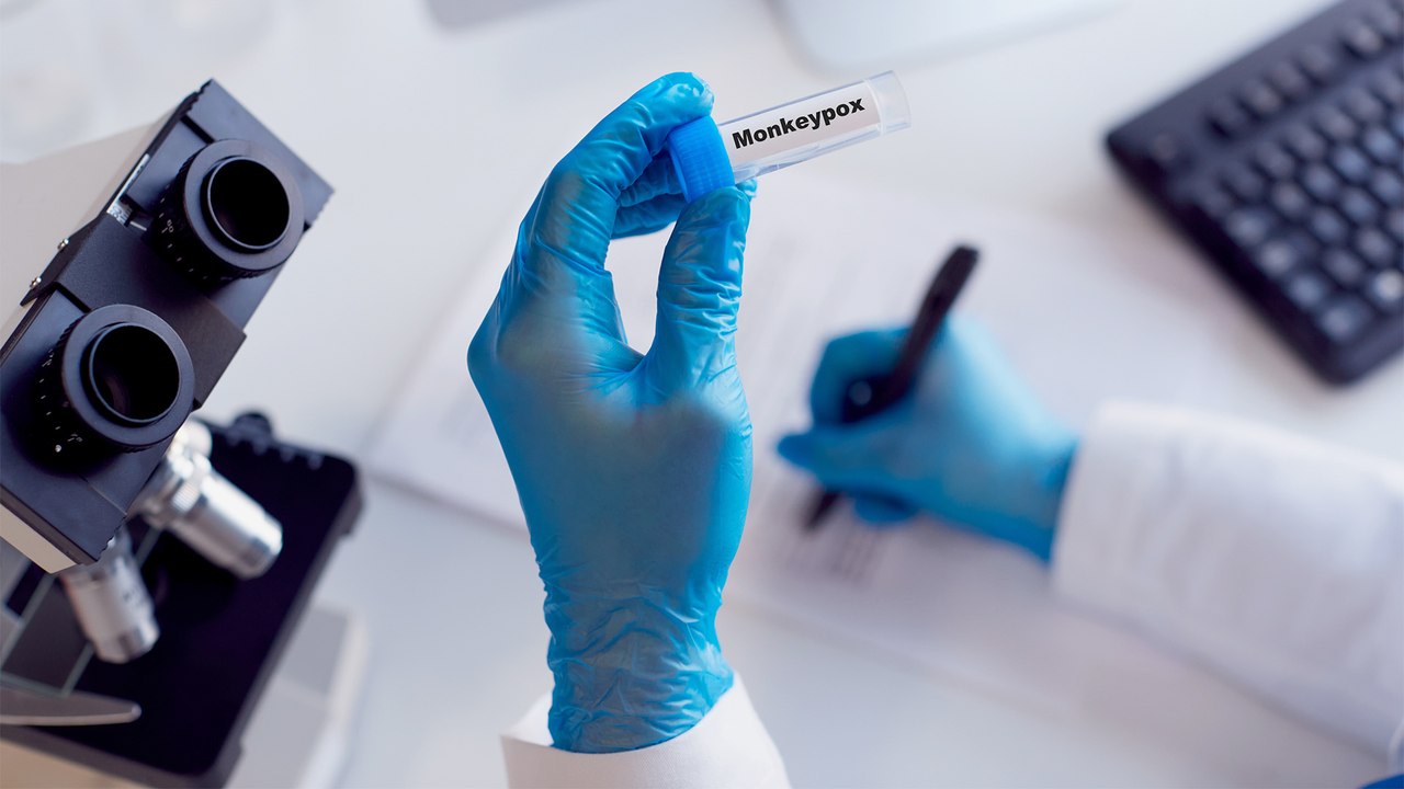 منظمة الصحة العالمية تعلن حالة طوارئ عالمية بعد تفشي مرض جدري القردة في 70 دولة