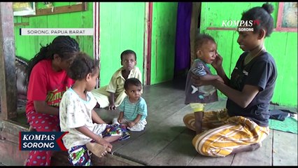 2 Anak Gizi Buruk Di Sorong Tak Miliki Biaya Pengobatan