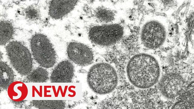 WHO declares monkeypox a global health emergency