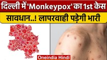 Monkeypox First Case In Delhi: दिल्ली पहुंचा मंकीपॉक्स |Global Health Emergency |वनइंडिया हिंदी*News