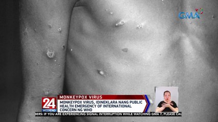 Monkeypox virus, idineklara nang public health emergency of international concern ng WHO | 24 Oras Weekend
