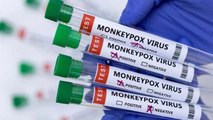 Monkeypox’s symptoms, causes and precautions: Medical experts answer key questions | Watch