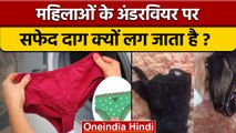 Womens के Underwear पर क्यों लग जाता है White Spots, जानिए कारण | वनइंडिया हिंदी | *News