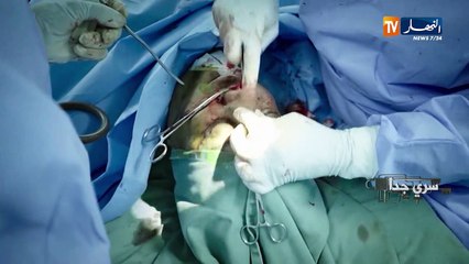 سري جدا/  وجوه في المزاد  ..حلاقات تقمنا بالجراحة التجميلية