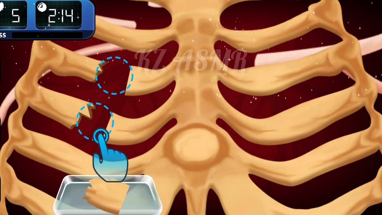 Ribs Fracture Fixture Treatment Animation ASMR Video 2022 KZ ASMR