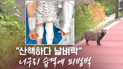 [뉴스라이더] 너구리 습격에 피범벅 "공원 산책하다 날벼락" / YTN