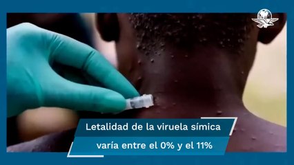 ¡Que no se te pase! Ellos son los más vulnerables frente a una infección por viruela del mono