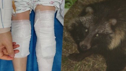 [더뉴스] '너구리에 피범벅' 야생동물의 역습...공존 방법은? / YTN