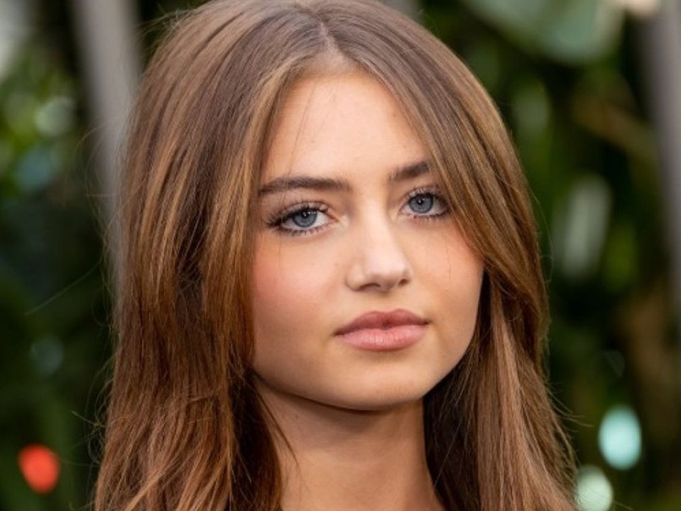 Schock für die Fans: Leni Klum zeigt krassen Sonnenbrand