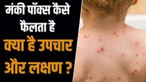 भारत में मंकीपॉक्स के मिले चार केस, जानिए क्या हैं उपचार और लक्षण ? | Monkeypox India
