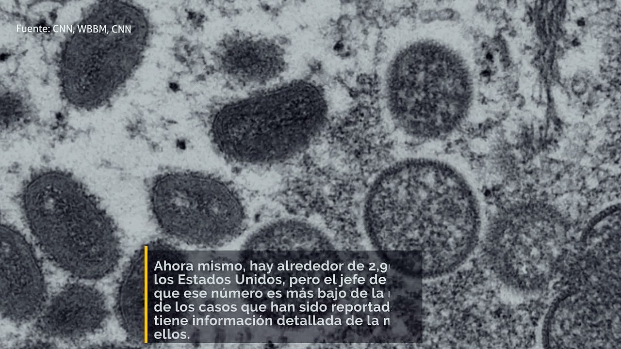 La viruela de mono se está propagando más rápido de lo que muestran los datos