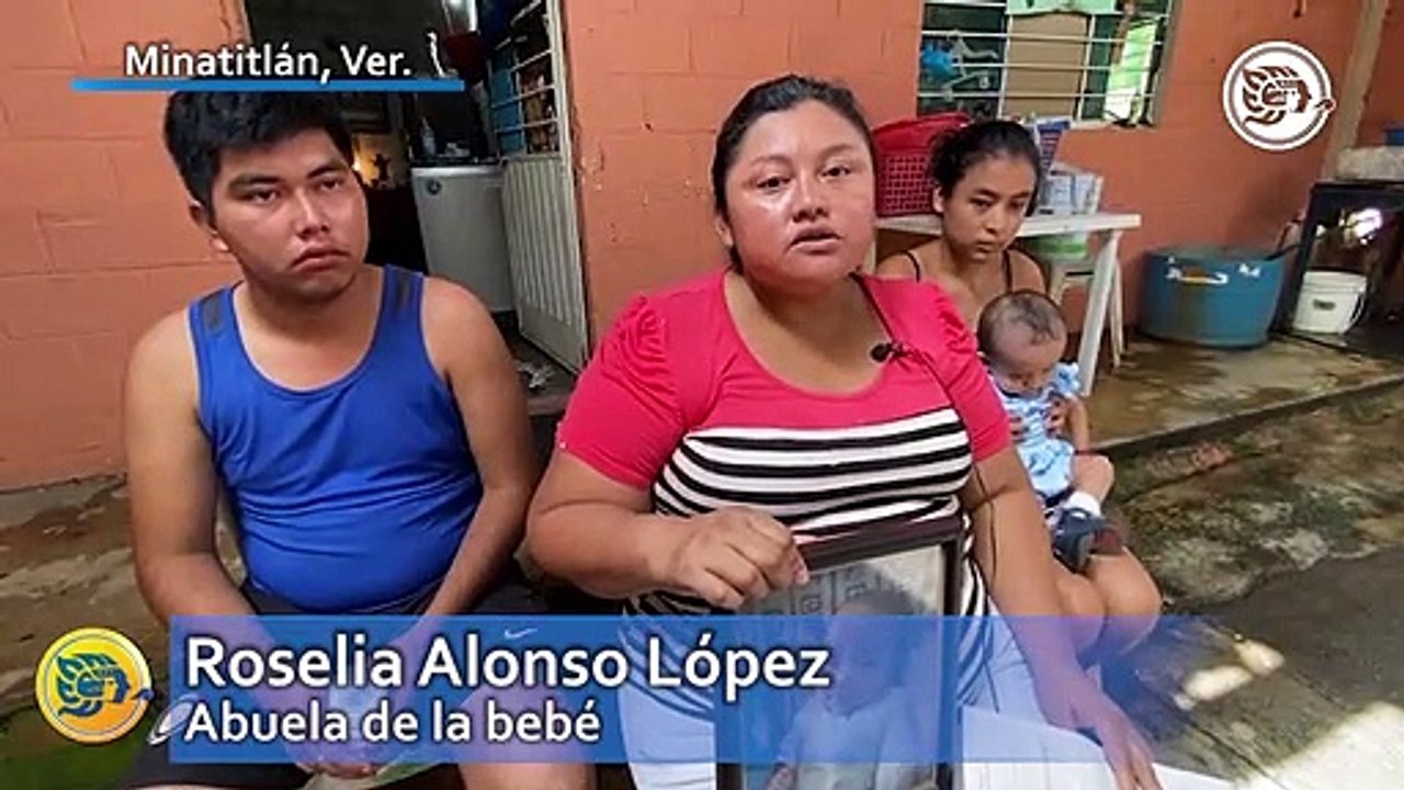 Claman ayuda para salvar a Yesica, gemela con padecimientos cardiacos