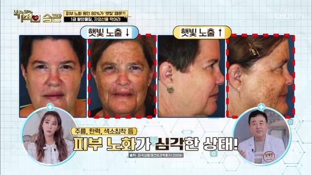피부 노화의 원인 피부암을 유발하는 자외선의 무서움 TV CHOSUN 220726 방송